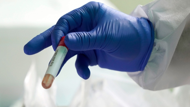 CP24's tweet photo. UPDATED: Ontario confirms 309 new cases of COVID-19, the lowest one-day increase since March 31 https://t.co/7InoQ7GzF0 https://t.co/LGYvuA63Gp
