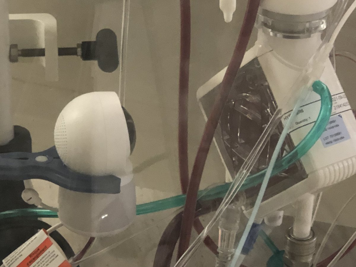 MILLERRCCP's tweet photo. Using Video/2way audio for WiFi Remote Monitoring of Oxygenator Pump Control screen on Covid-19 patient on ECMO. Keeping staff out of isolation area but still constantly monitoring key equipment. Giving volume from outside isolation room.  Less PPE used.# @FOAMecmo, # @ECMOdaily https://t.co/3J3wiB7tPW