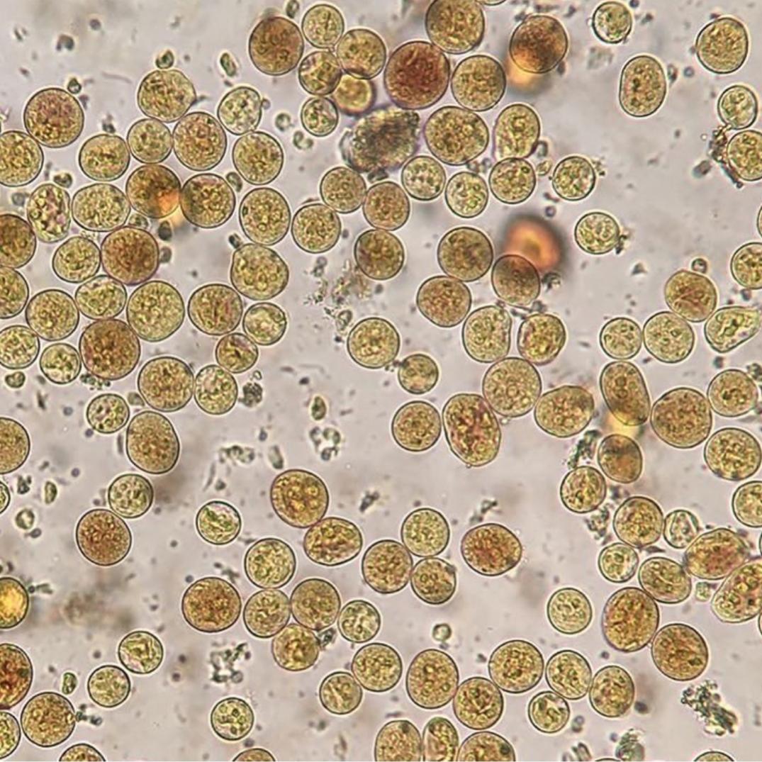 cariosoma entamoeba histolytica cariosoma entamoeba histolytica