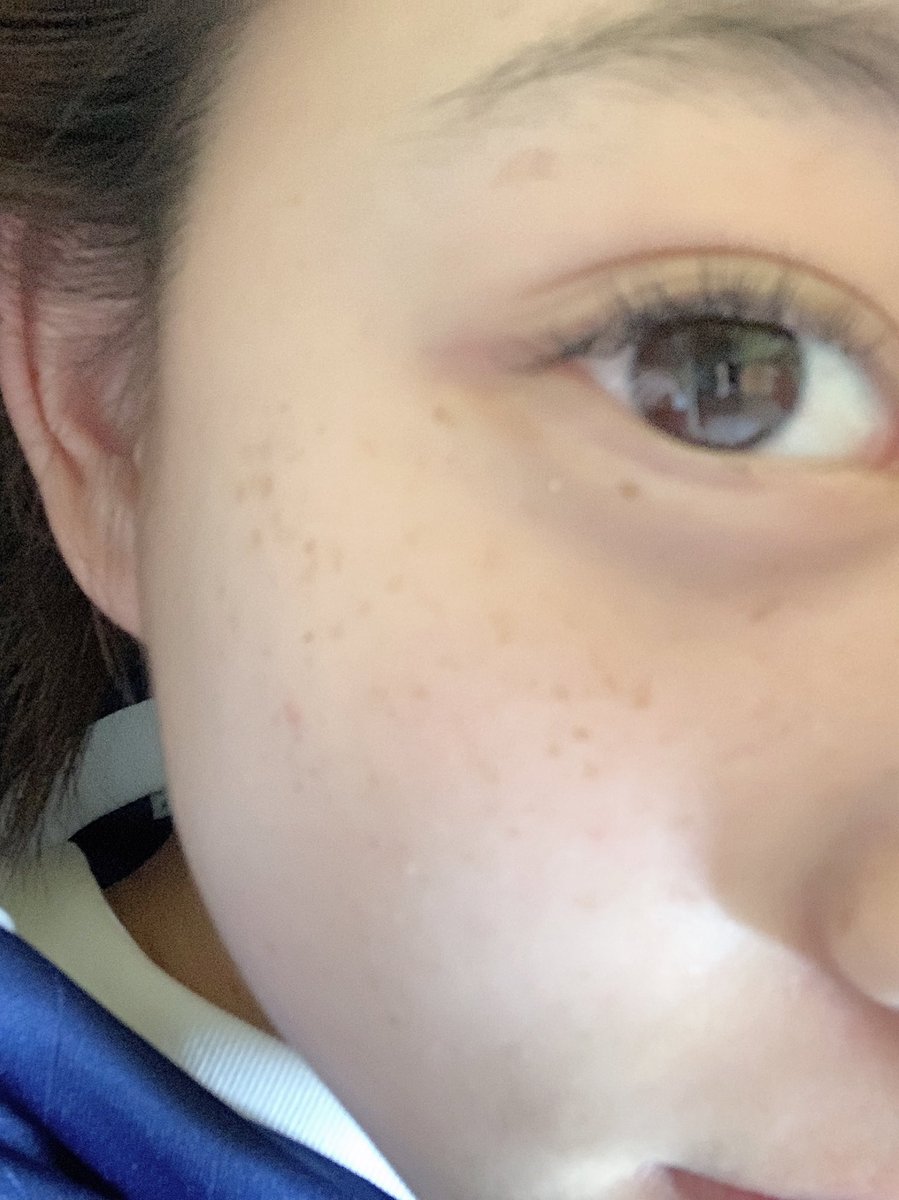 あーーゆ そばかすちゃん 可愛がって