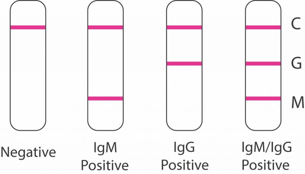 The blood serologies can be used in different ways, but require interpretation. Finding IgM in the blood can help establish active or recent infection, but has sensitivity limitations, particularly early in acute infection.