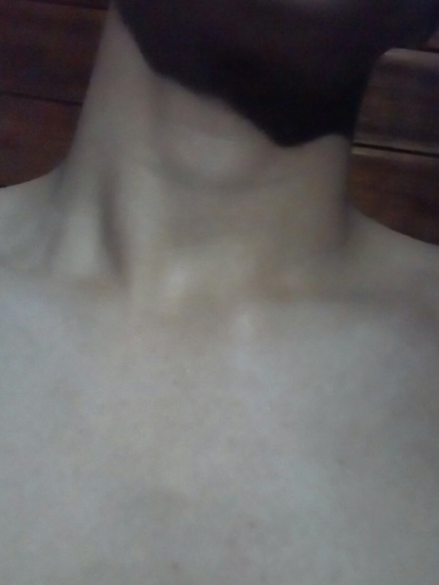 Ronel081's tweet photo. Ughhh# vidjakol#alter#top https://t.co/AmaV3LdWrl