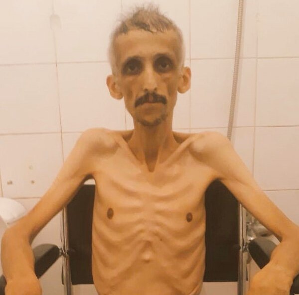 exc_luisive's tweet photo. Helin gözlerimizin önünde sahiplenemediğimiz için ! avuçlarımızdan kayıp sonsuzluğa gitmiş olsa da en azından günden güne eriyen İbrahime sahip çıkalım !!! #İbrahimGökçekYaşamalıdır https://t.co/b67el9pex1
