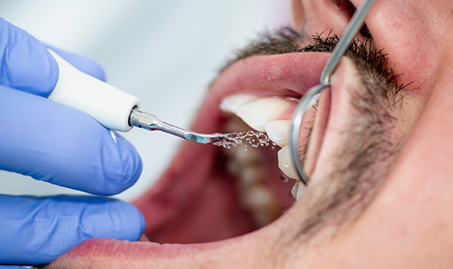DPR_Magazine's tweet photo. Knowing when #periodontal maintenance is needed versus #prophy will help deliver the best oral care for your patients: https://t.co/XeoHlP4bCH https://t.co/DlX6xdsLtt