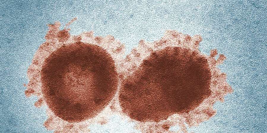cibercrimen's tweet photo. Se liberan estándares ISO para consulta, incluyendo de resiliencia en ciberseguridad para estos momentos del coronavirus. (Inglés) https://t.co/q3tg9MnUkD https://t.co/JkhSqb1Ab0