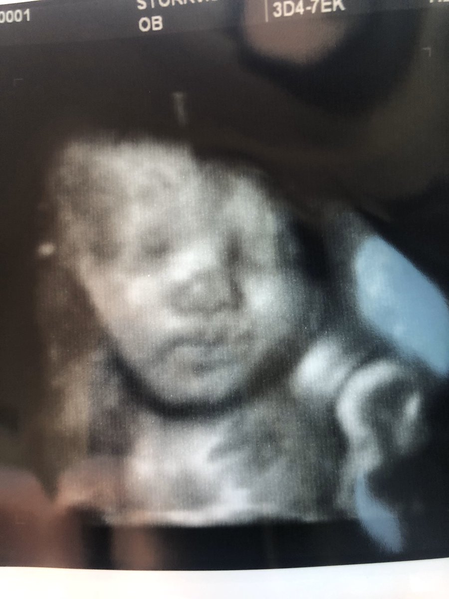 KyleighCK's tweet photo. only 8 more weeks until I become Aunt Ky🙏🏼 @MacyMarshall1 your going to be such a great mom I can not wait😍 https://t.co/WxW2pn6W7h