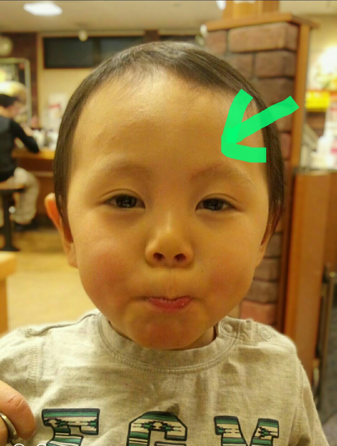 顔の傷 Twitter Search Twitter