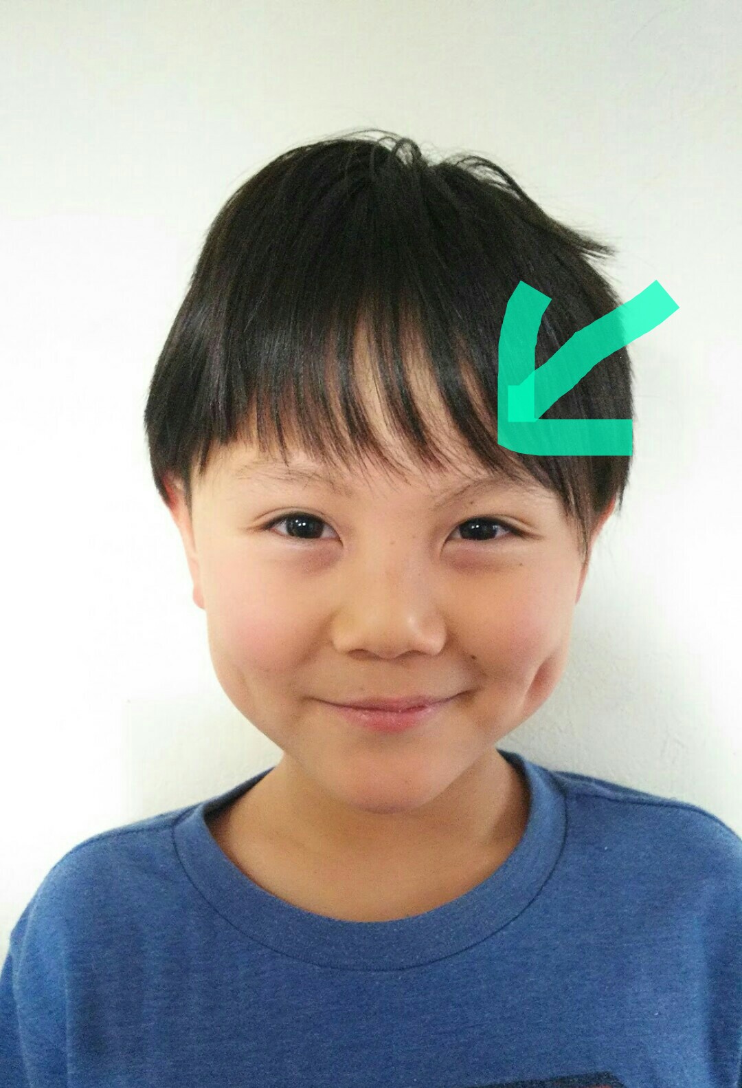 顔の傷 Twitter Search Twitter