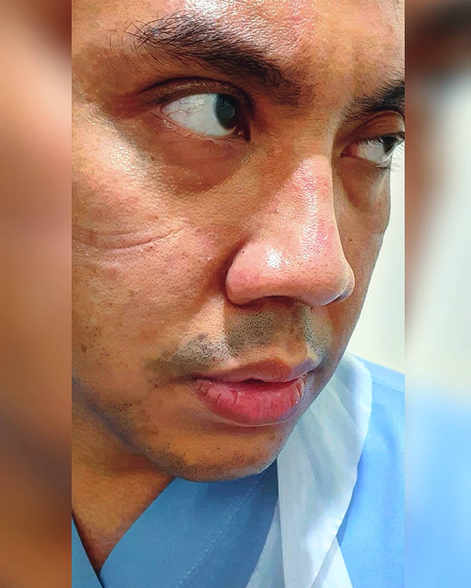 It will be a very long battle ahead.

Bukan hanya buat kami para tenaga kesehatan, tapi buat semua teman2 di rumah

Bosen.
Stress.
Kesulitan keuangan.

Tapi kita harus kuat, tabah, dan tawakkal.

Ini perjuangan kita bersama.

Jadi, keep holding on.

We will make it thru together.