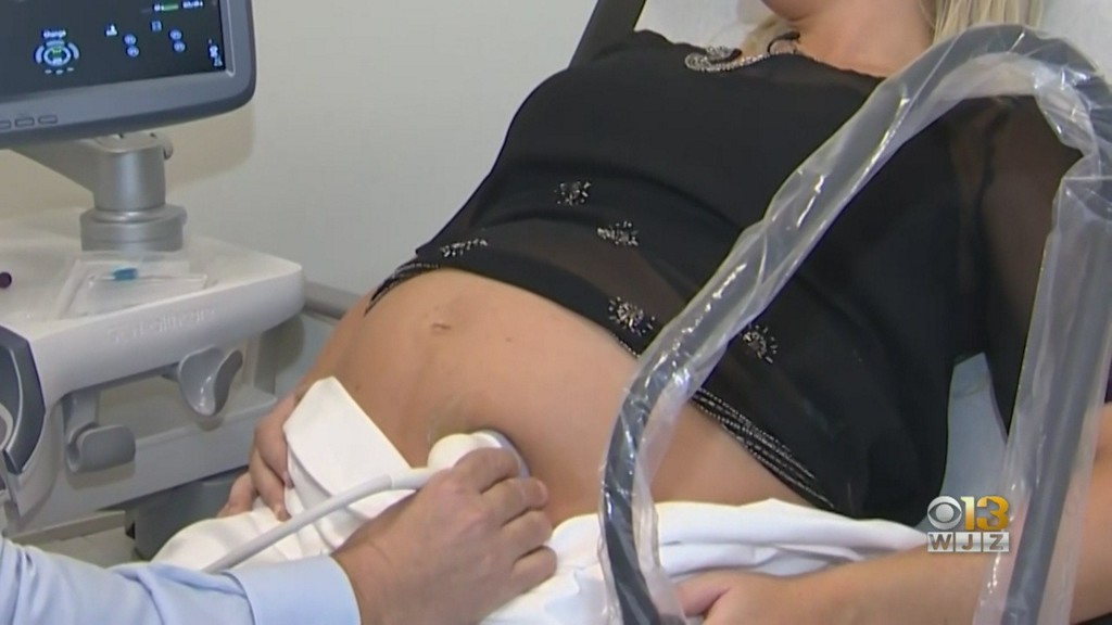 wjz's tweet photo. Local Doctor: Pregnant Woman Shouldn't Fear Delivering Baby At Hospital Amid COVID-19 Pandemic https://t.co/5DrjWIRgsx https://t.co/kTKK4NfIoc