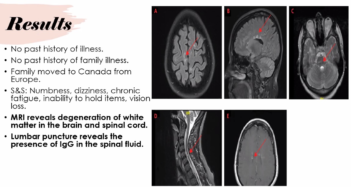 TaraVatNAC's tweet image. Another great student-developed #CaseStudy session using @zoom_us today in #Pathophysiology @NunavutCollege #NACnursing in #Iqaluit Classes are suspended but students requested  "getting this done" so here we are, #GettingItDone #KitchenOfficeHours #HigherEd #IsolationInstruction