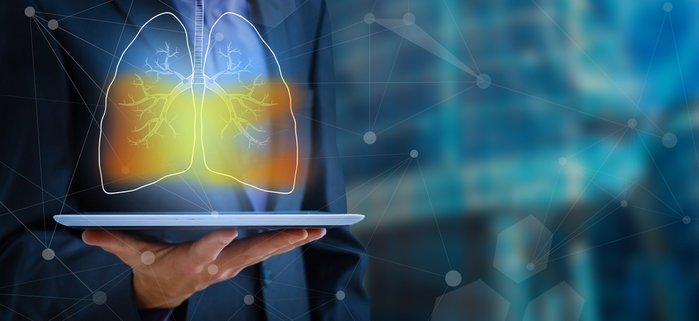 medtechonline's tweet photo. Q&A: The development of an AI solution to diagnose COVID-19 pneumonia: https://t.co/XCKMwFiJCn #BioMind #medtech #COVID19 #AI https://t.co/uR1zMVh54s