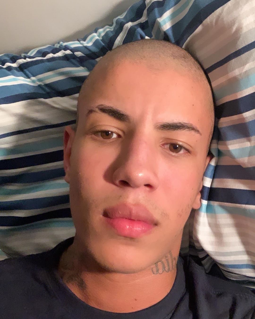 Me arrependi por ficar careca? 