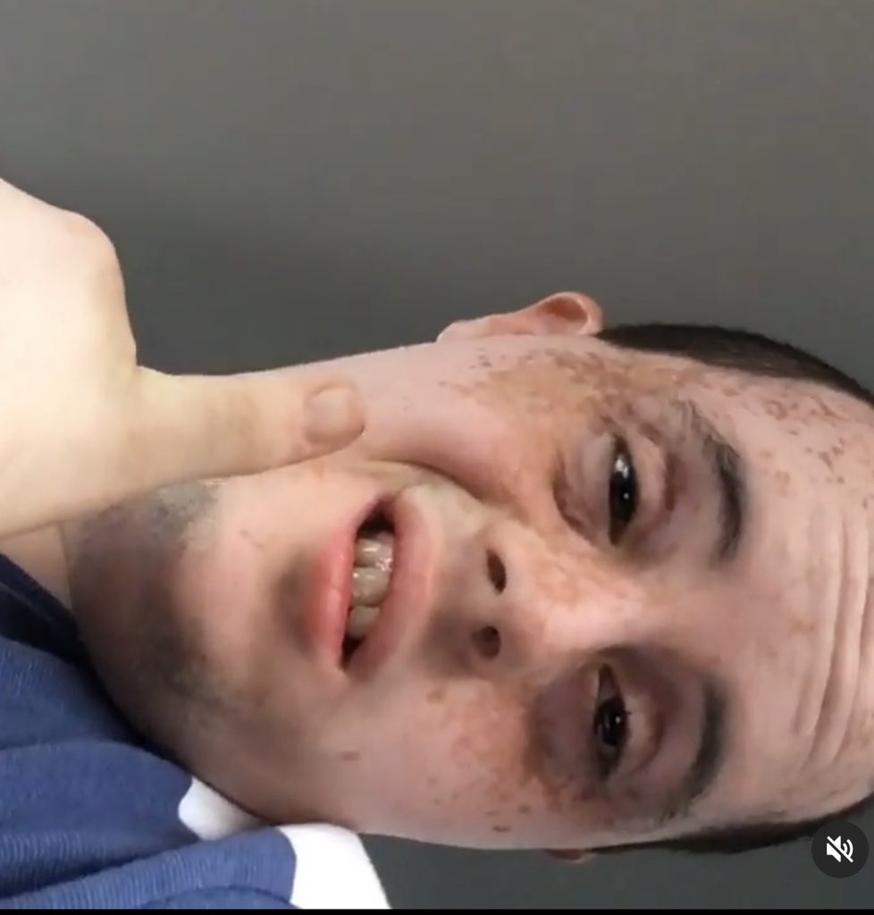 emyxxx0's tweet image. Please HELP my brother with Down syndrome went missing his name is Erwin Lopez he's 21 years old BROWARD COUNTY AREA if you find him please CONTACT  me or call 911