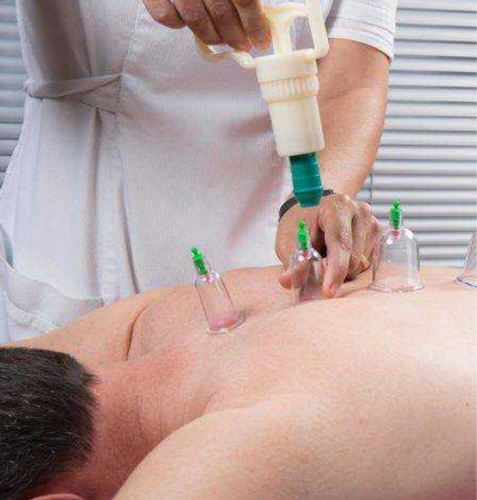 HijamaLife's tweet photo. What does Hijama do to your body?
It involves placing cups on the skin to create suction. ... Cupping increases blood circulation to the area where the cups are placed. This may relieve muscle tension, which can improve overall blood flow and promote cell repair. https://t.co/VSLefEBh2D