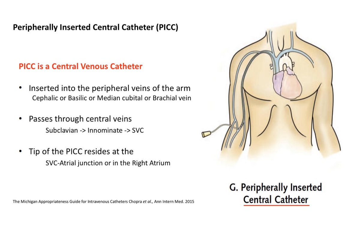 picc in innominate vein