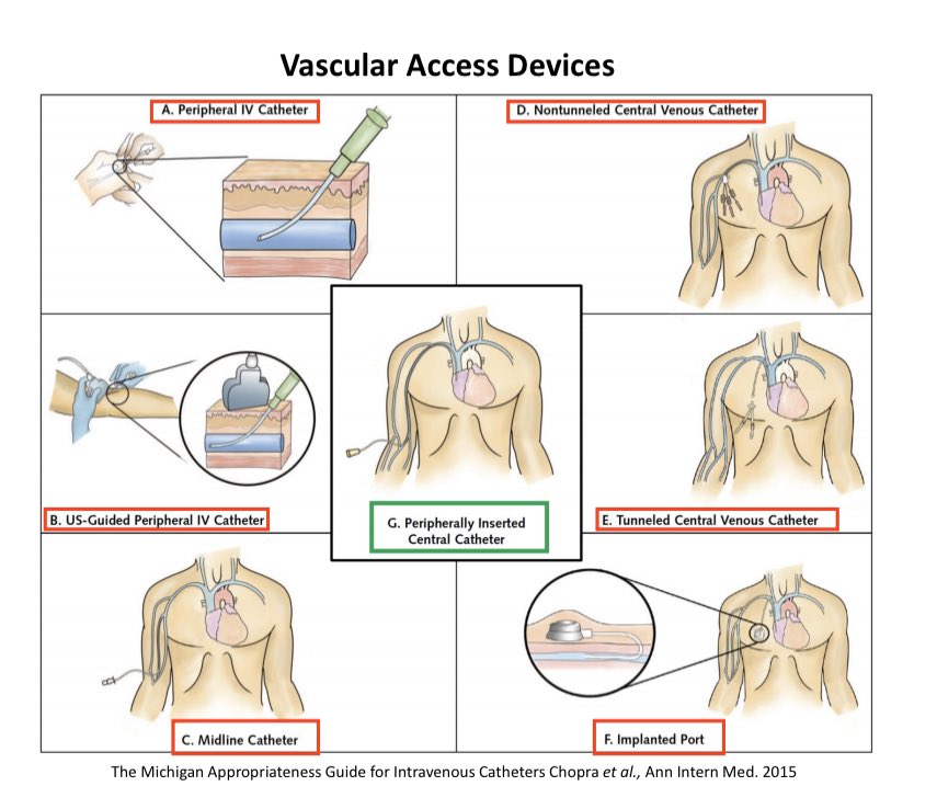Vascular Access with Port Systems