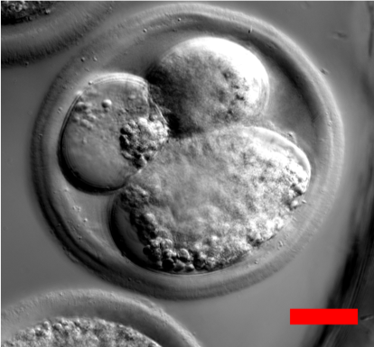 qlilab's tweet photo. Label-free image of bovine embryo using GLIM
#QliLab #QPI #Labelfree #SLIM #GLIM #DPM #PhiOptics
#UIUC #BeckmanInstitute https://t.co/JNb8DPJ2fR