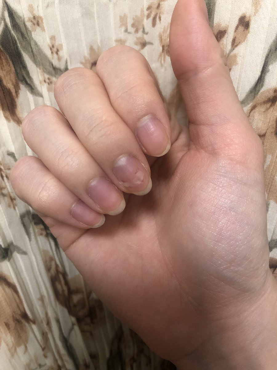 桃月なしこ No Twitter 爪の傷なめてた ありがとう