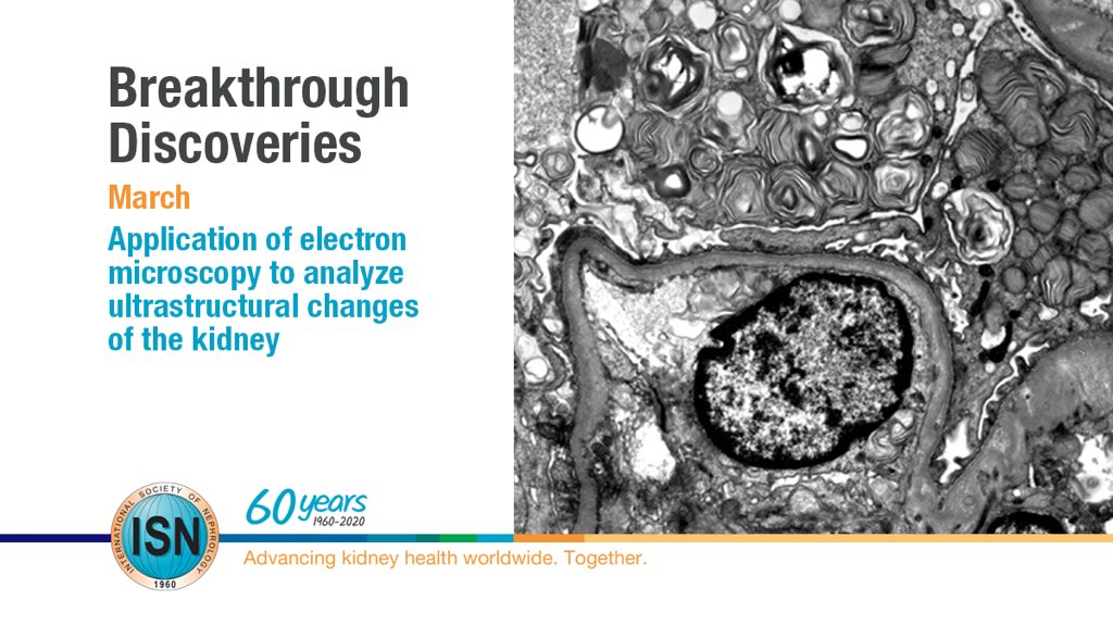  Application of electron microscopy to analyze ultrastructural changes of the kidney https://www.theisn.org/60th-anniversary/breakthrough-discoveries/breakthroughs-in-march/application-of-electron-microscopy-menu  #ISN60years