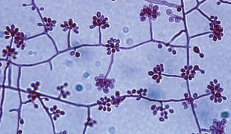 harsimarbhatia's tweet image. Kudos to all the Path educators, who are continuing teaching in these uncertain times! What do you think these beautiful (hint: rosette-like) organisms are? #microbiology #pathology