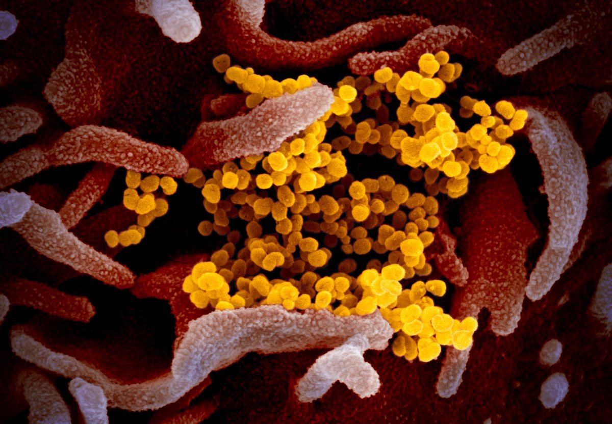 Our friends at Echtralex have compiled a glossary of English and Chinese terms relevant to the Novel Coronavirus and its spread across the globe.  buff.ly/2UjV78s