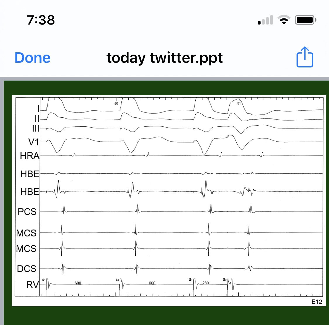EPrystowskyonEP's tweet photo. #EPunknowns #EPeeps @HRSonline @andreanatalemd @DrRoderickTung @LuigiDiBiaseMD @BradClarkEP @GilgeJasen https://t.co/h3WqiZwiUg