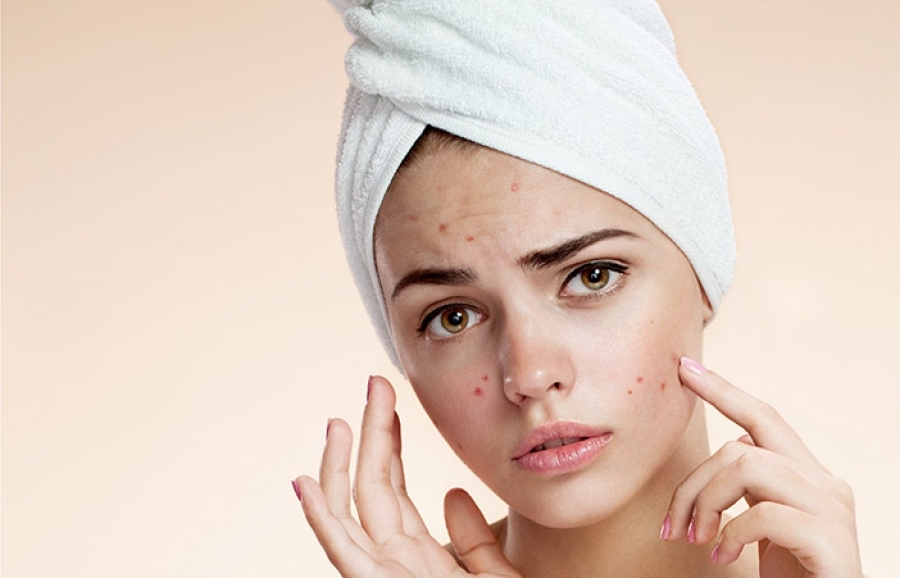 scholarships360's tweet photo. Have you been treated for a dermatologic condition? These nine (9!!!) #Scholarships worth $10,000 are so worth applying for! Open to #ClassOf2020 high school seniors! 
https://t.co/kVEhMqSbuF https://t.co/7iww0ZNJVq