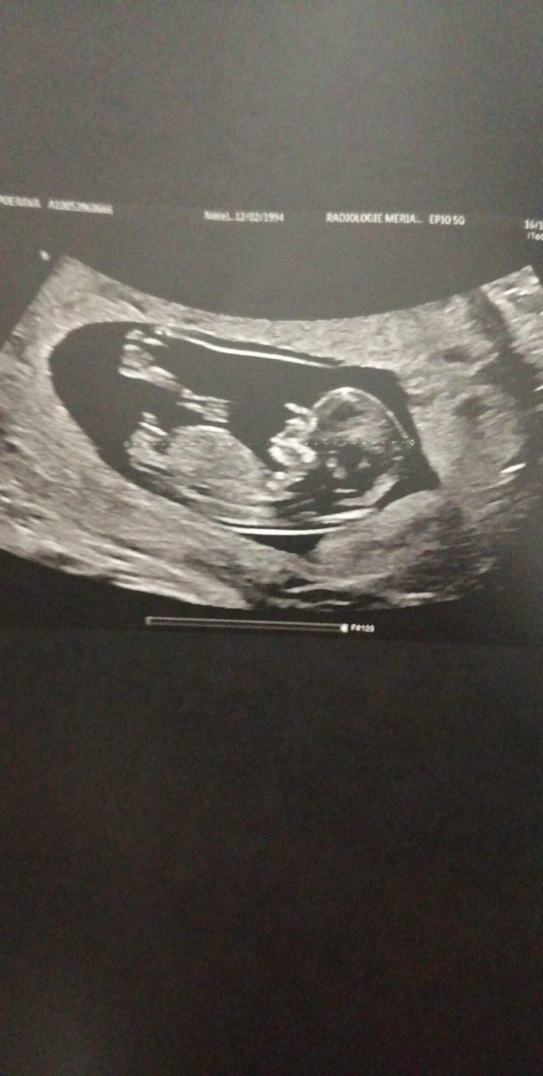 SPoerava's tweet photo. C'est fou de se retrouver seule avec un enfant, quand tout le monde te retourne le dos et juge cette enfant comme : "il gâchera ta vie"
C'est fou de se dire que cette être si innocent et même pas entre nait, fait déjà objets de critiques et de jugements .
#myson #baby #mavie https://t.co/F7Dvz3RfC1