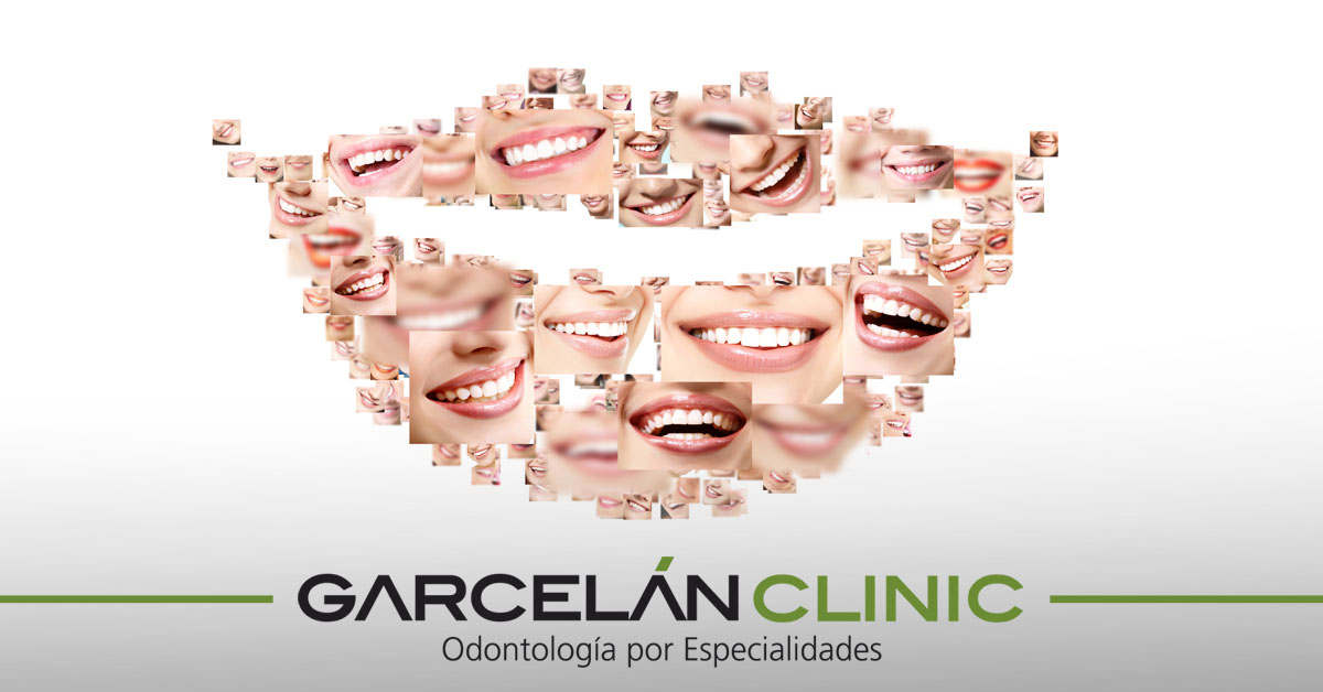 GarcelanClinic's tweet photo. ¿Estás ya un poco aburrido/a con esto del confinamiento y te apetece informarte sobre cosas nuevas? Échale un ojo a nuestro blog, con mucha info y consejos sobre #SaludDental y #odontología en general ;) https://t.co/kKUFZsqLQu https://t.co/eTJwbH6kOX
