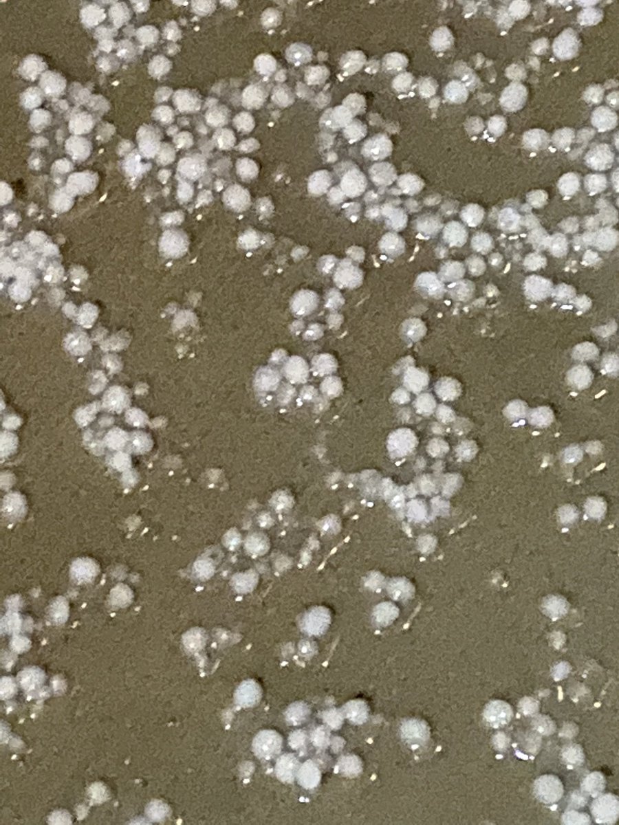 GrrArrgh's tweet photo. It’s hailing in San Diego. I’ve lived here 18ys, this is a first. I need the world to just settle back down for a bit. #WhatsHappening #SanDiego #NotMyWeather https://t.co/DqoQnhDeKy
