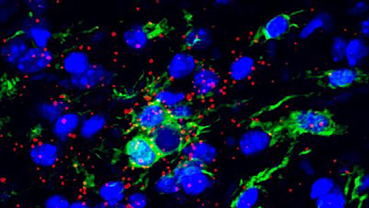 ZuckermanBrain's tweet image. NEW RESEARCH: @ZuckermanBrain scientists have identified a gene called #TBK1 that acts as a double-edged sword in #ALS — first slowing, then accelerating ALS progression in a mouse model of the disease: zuckermaninstitute.columbia.edu/double-edged-s… 1/5