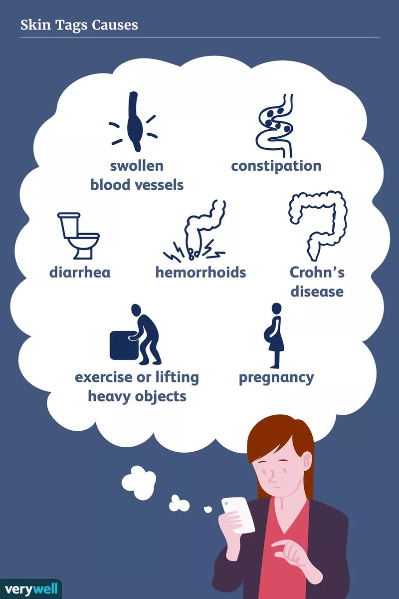 Skin tags are raised areas or bumps on the outer surface of the skin which are not usually painful. For small skin tags or ones that aren’t causing any symptoms or discomfort, it might not be worth removing them or removing them right away. 
verywellhealth.com/anal-skin-tags…