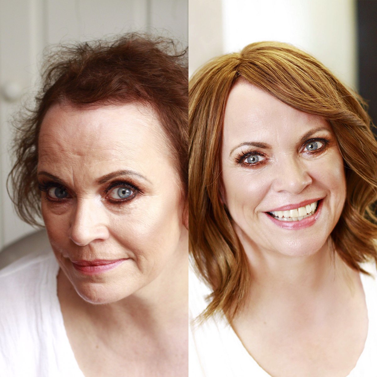 Hair Solved tweet media