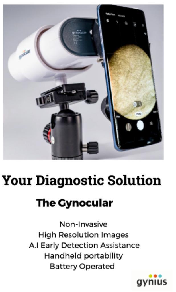 Gynocular's tweet photo. Awesome News! New technologies continue being used to #endcervicalcancer. Our #gynocular is a handheld, portable, non invasive colposcope with #artificialintelligence capabilities to assist screen and treat programs, everywhere. https://t.co/XsWcLBmBcI