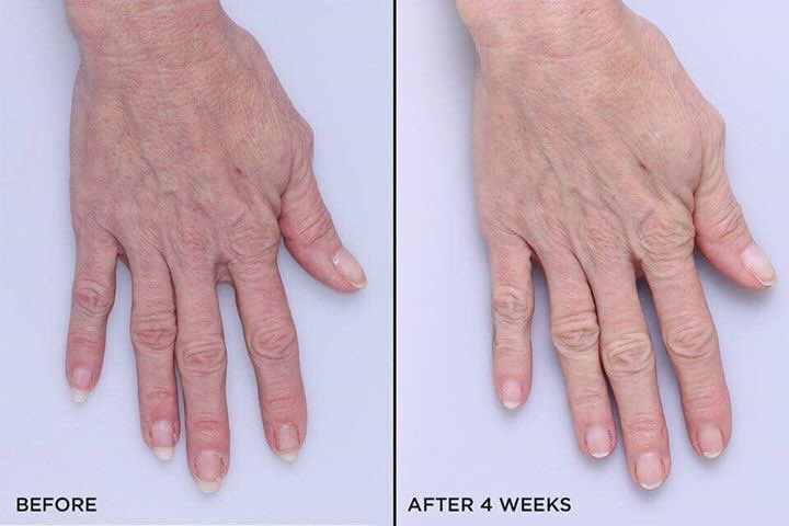 annette_addy's tweet photo. Your hands are one of the first places to show signs of aging &they need some TLC right now. This creme is perfect! keep one in the car, at your desk, and one beside every sink. On BOGO now! https://t.co/052w8VSBUH
#aloette #myaloettexoxo #aloeganic #farmtojar #antiaging https://t.co/Yn1lqz9Q6Y