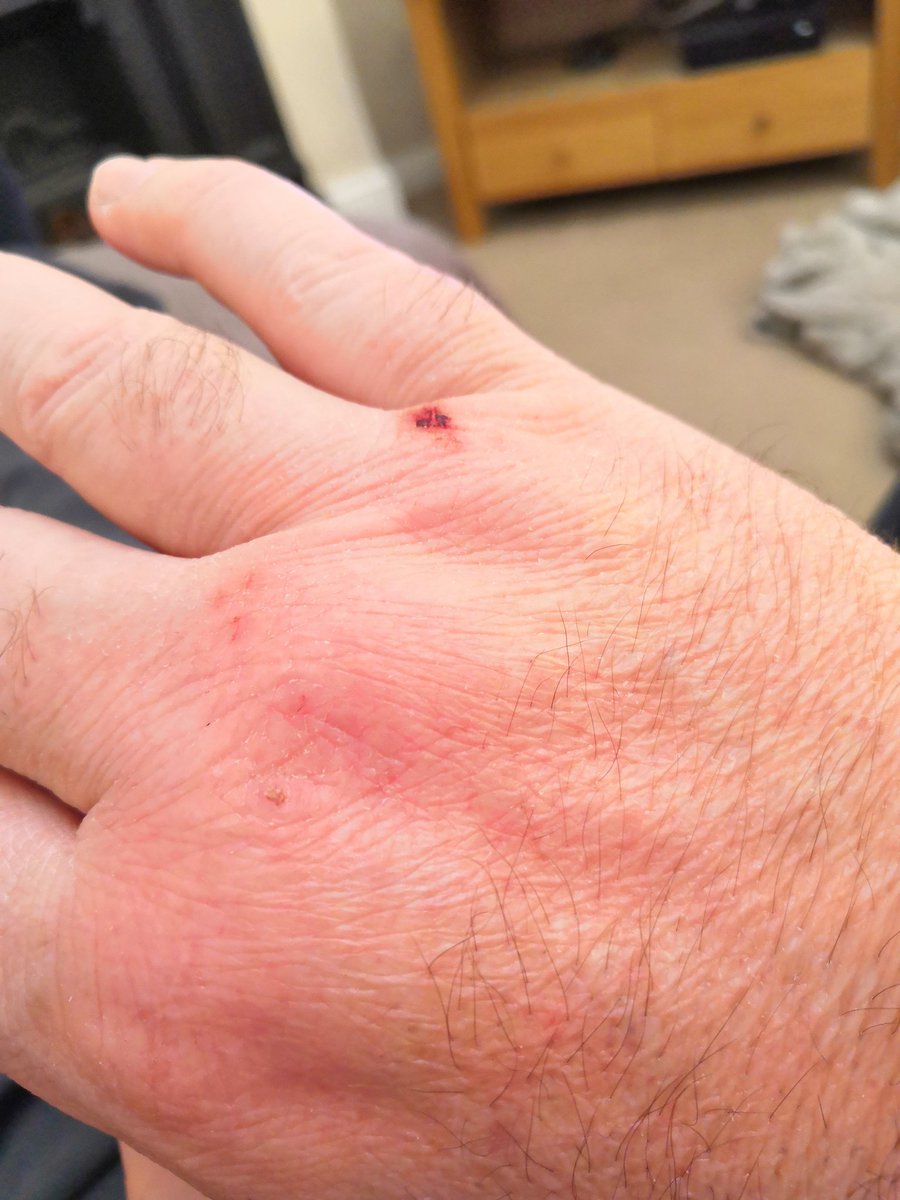 Firesnapper999's tweet photo. I maybe #RuftyTufty, but fcuk! Repeated hand washing &amp; sanitiser causing hand torture, cracking &amp; dry. This @Neutrogena stuff is bliss 🙏👍 And yes, 1500 too early for lounge wear? 🤗 #RuftyTuftySoftie https://t.co/1v715IsQla