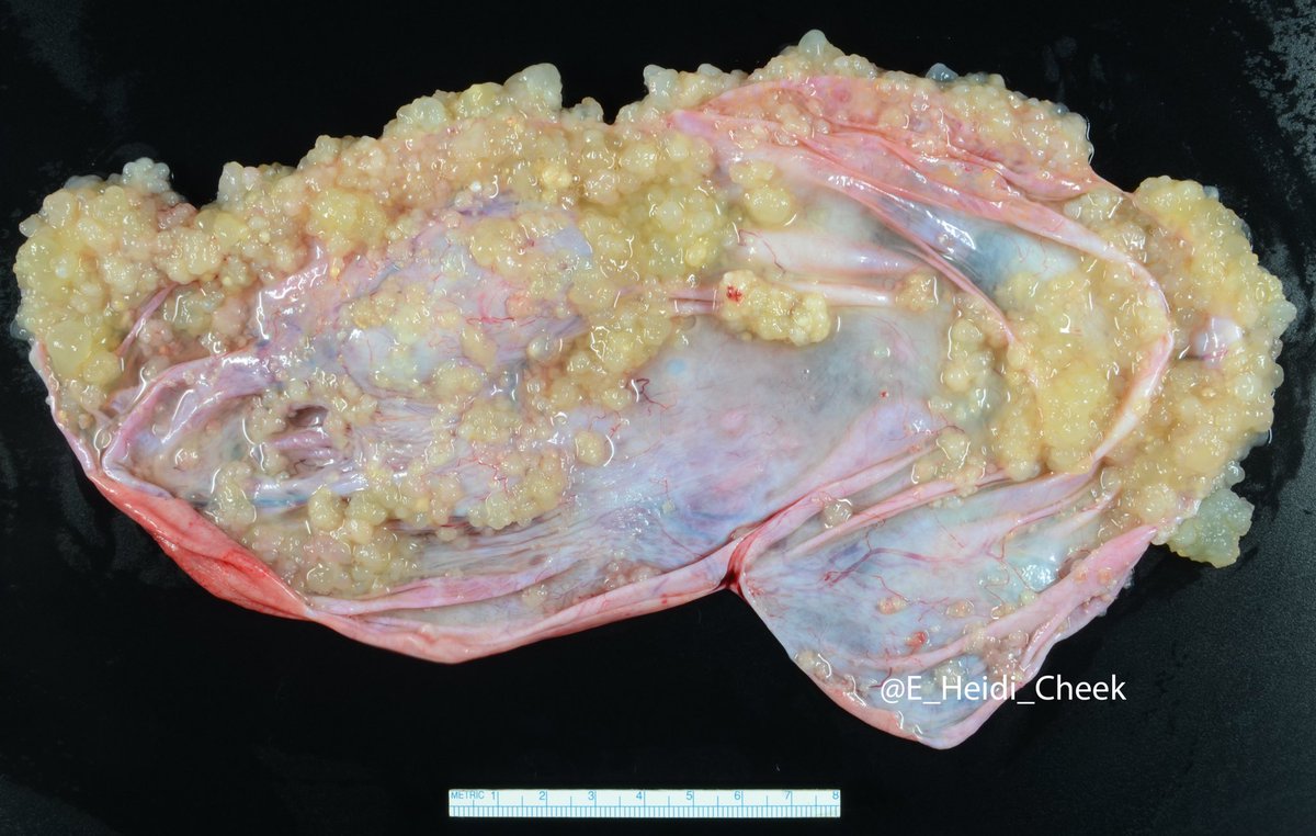 E. Heidi Cheek, MHS, PA(ASCP) tweet media