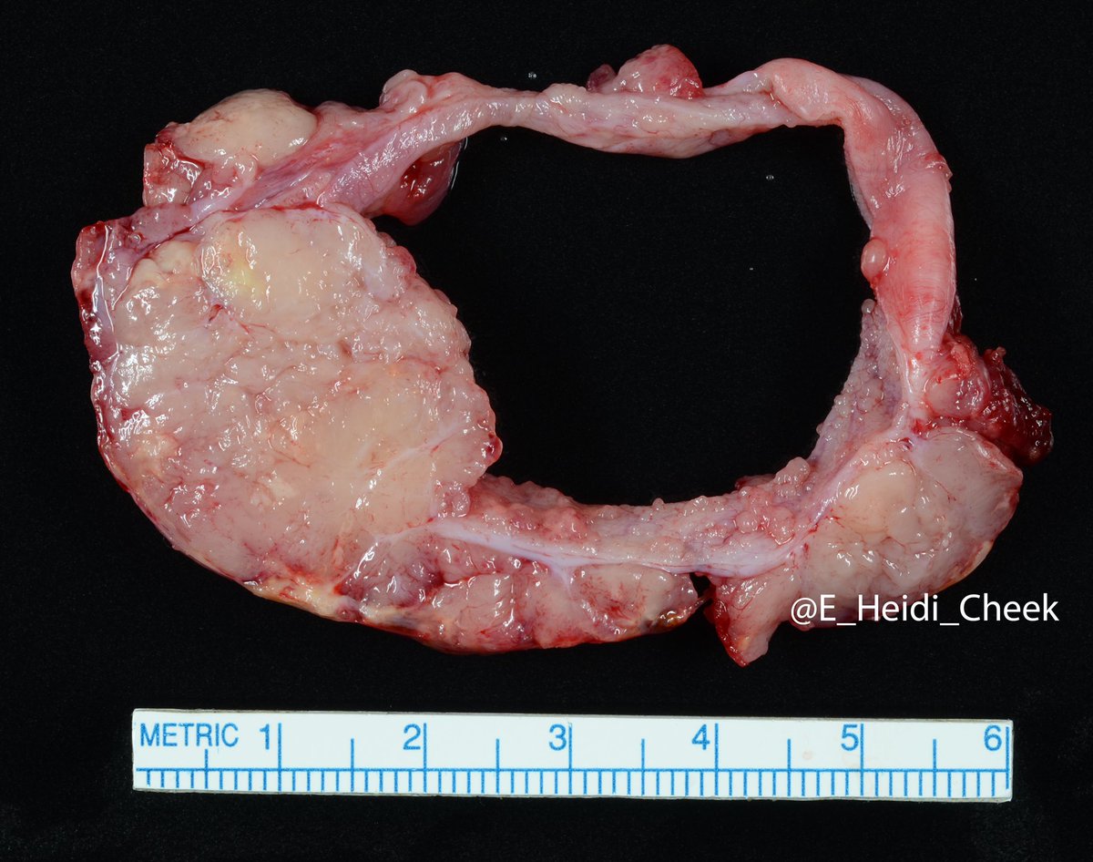 E. Heidi Cheek, MHS, PA(ASCP) tweet media