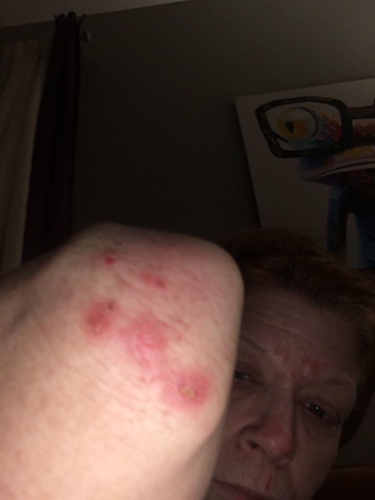 TamRealtor's tweet photo. @usatf US Airforce plz help as I’m being hit at home in Indiana by some type of radiation possible AI here are pic Tammy Bryan https://t.co/d2BgOLDvEl