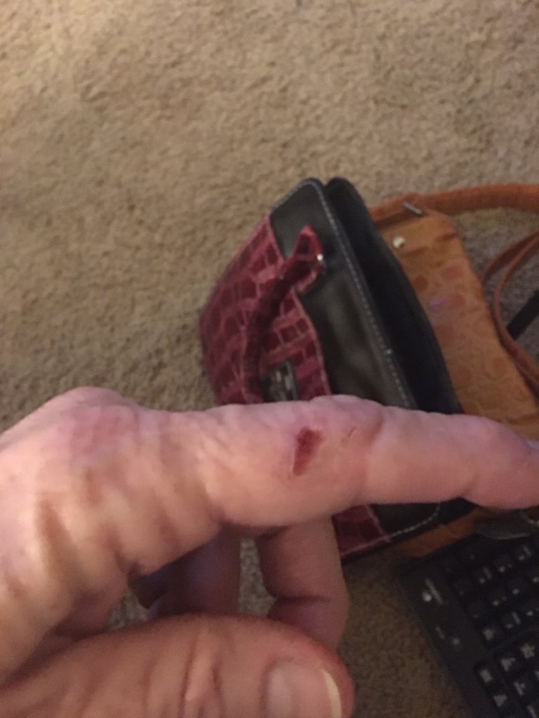 TamRealtor's tweet photo. @usatf US Airforce plz help as I’m being hit at home in Indiana by some type of radiation possible AI here are pic Tammy Bryan https://t.co/d2BgOLDvEl