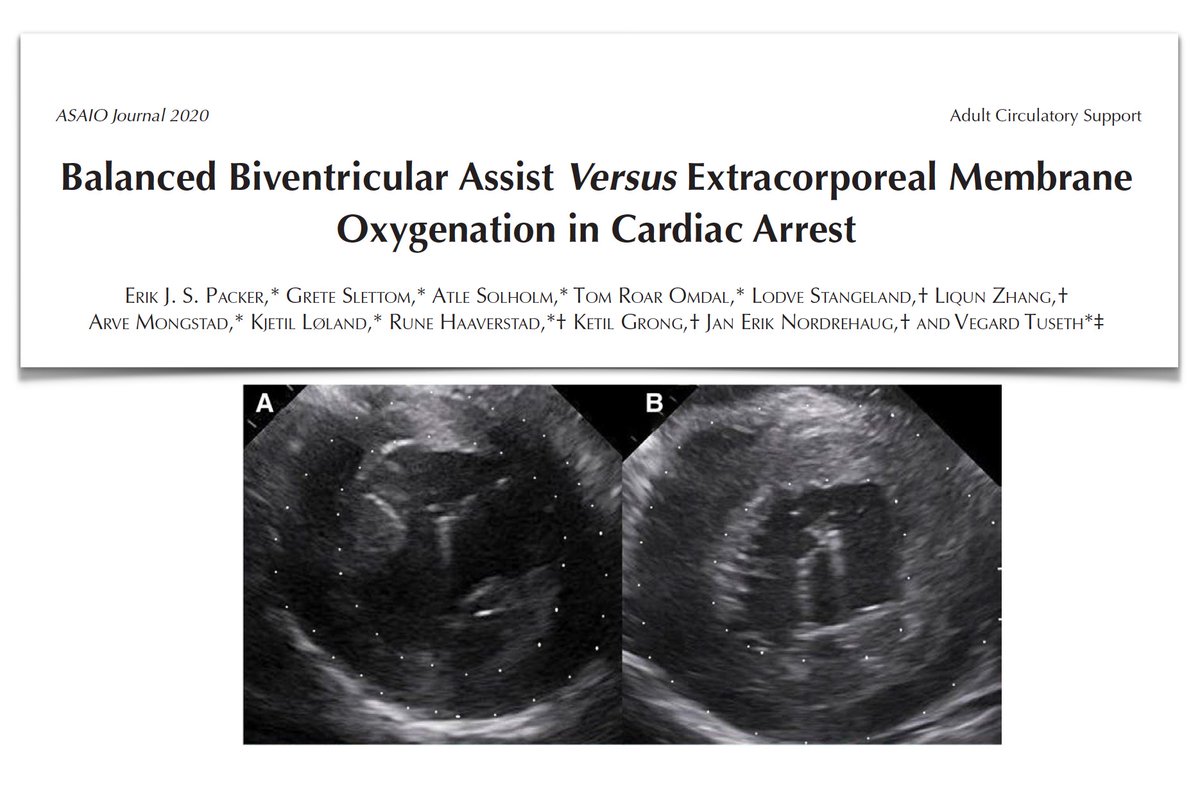 FOAMecmo's tweet photo. Impact on hemodynamics/organ perfusion during cardiac arrest of VA #ECMO vs percutaneous BiVAD
both #ECPR & balanced #BiPella could sustain organ
function/CPP during VF; #ECLS provides more optimal support related to near physiologic output @asaiojournal https://t.co/mepQS0ejj7 https://t.co/pXIpUwUKGA