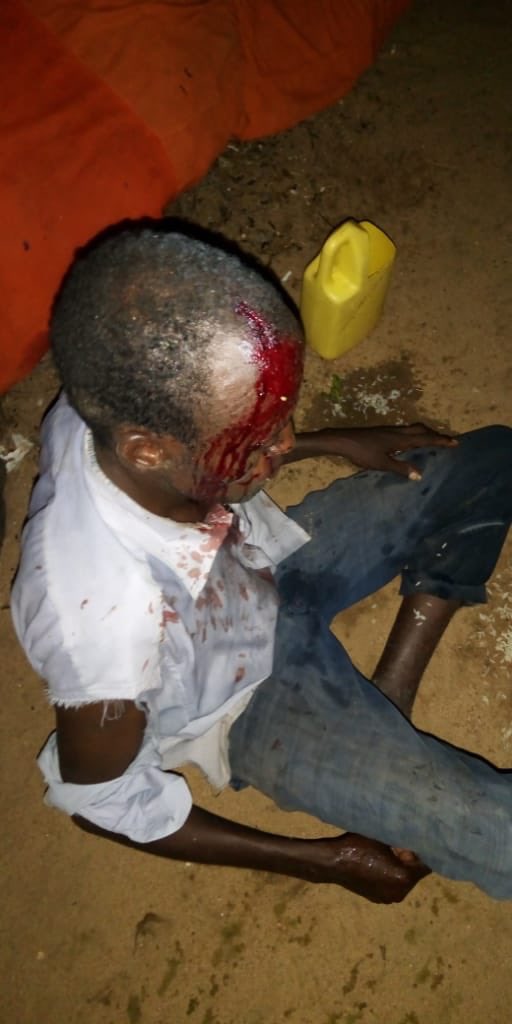 AbdiAli047's tweet photo. This man is called maqnata well known in Modogashe. He is a poor casual worker in Modogashe. He has been beaten by police officers from sericho police station. They had the option to arrest him instead of brutally injuring him like that. @FredMatiangi @Asmali77 @DCI @Husseincesh https://t.co/iQegxEgBiw