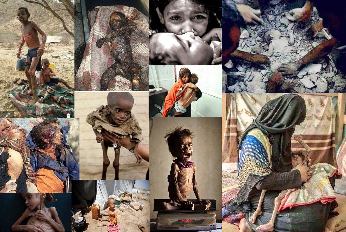 sonofman1272's tweet photo. Invasion, assassination are gifts to #YemenChilderen;
#SaudiAraibia with the direct support of USA attack with the most lethal weapons and bombs to Yemen during last 5 Years in silence of @UN, let's pray for Yemeni people to stay stand against this cruelty.
#5YearsOfWarOnYemen https://t.co/TsbJYXWkix