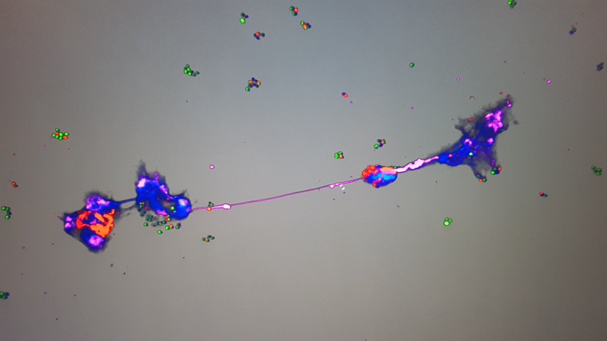 JeffMewburn's tweet photo. Just imaging some human neutrophil nets on Friday before we shut the #archerlab down for a bit. Already cant wait to get back to the lab @queensuResearch @DrStephenArcher with @KimSnary https://t.co/TdPUVqD9uO