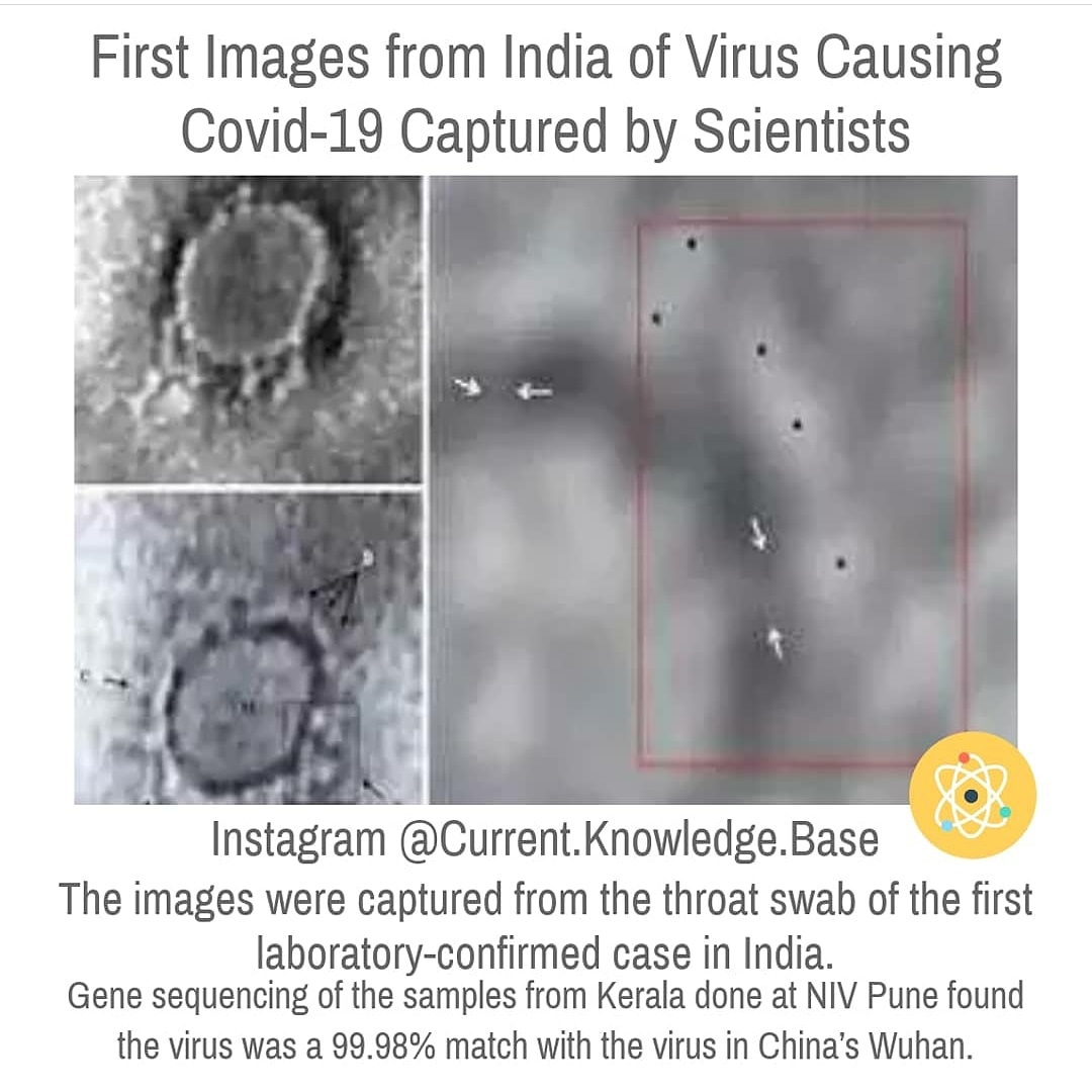 FactPro_'s tweet photo. First Images from India of Virus Causing #Covid19 Captured by #Scientists!

#CurrentKnowledgeBase #CurrentAffairs  #DidYouKnow #Facts #DailyFacts 

#17VictoriousYrsOfAlluArjun #CoronaLockdown #CoronaVirusUpdate #COVID #StayHomeSaveLives #StayHomeStaySafe https://t.co/m3SStbabPC