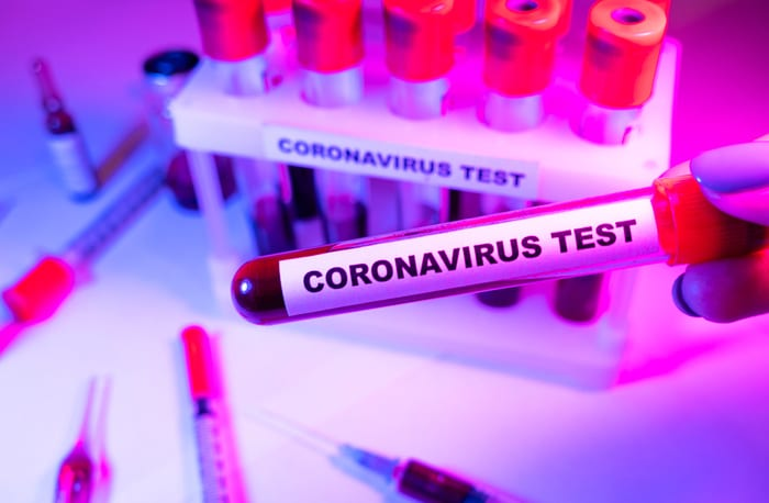 covidvu's tweet photo. We are adding #CoronavirusOutbreak testing data to #COVID19usa charts, US totals and per state.  Please let us know of #reliable testing #datasources for the countries in the top 10 number of confirmed cases - please #stayhome latest info at https://t.co/aMZFvp2LFW https://t.co/zSue4TGnnt