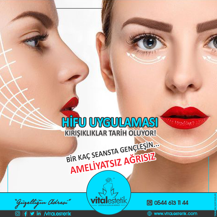 vital_estetik's tweet photo. #vitalestetik #antalya #güzelliksalonu #güzellik #antalyagüzelliksalonu #güvenilirlazerepilasyonu #güzellikmerkezi #beauty #kavitasyon #dermapen #hacamat #selülit #leketedavisi #tbt #woman #girl #beautysalon #laserepilation #lazerepilasyon #mezoterapi #dövme #dövmesilme #hifu https://t.co/wlXiJlGkc9