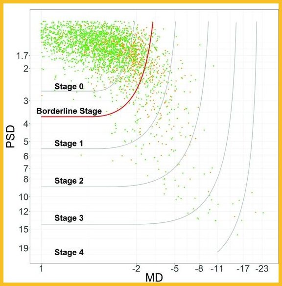 Crabb Lab Research (@crabblab) on Twitter photo 📌New paper📌
bjo.bmj.com/content/early/…
Most people with ocular-hypertension don’t need to be in swamped hospital eye clinics #NHS
Great work by our Stephen Kelly <a href="/anthonykhawaja/">Anthony Khawaja</a> Profs A-Blanco & Sparrow <a href="/CPH_QUB/">QUB Public Health</a> <a href="/RCOphth/">Royal College of Ophthalmologists</a> <a href="/Egret_plus/">Egret Plus</a> <a href="/BMJ_Ophth/">Ophthalmology at BMJ</a> #glaucoma
❤️#StayHomeSaveLives 📌New paper📌
bjo.bmj.com/content/early/…
Most people with ocular-hypertension don’t need to be in swamped hospital eye clinics #NHS
Great work by our Stephen Kelly <a href="/anthonykhawaja/">Anthony Khawaja</a> Profs A-Blanco & Sparrow <a href="/CPH_QUB/">QUB Public Health</a> <a href="/RCOphth/">Royal College of Ophthalmologists</a> <a href="/Egret_plus/">Egret Plus</a> <a href="/BMJ_Ophth/">Ophthalmology at BMJ</a> #glaucoma
❤️#StayHomeSaveLives