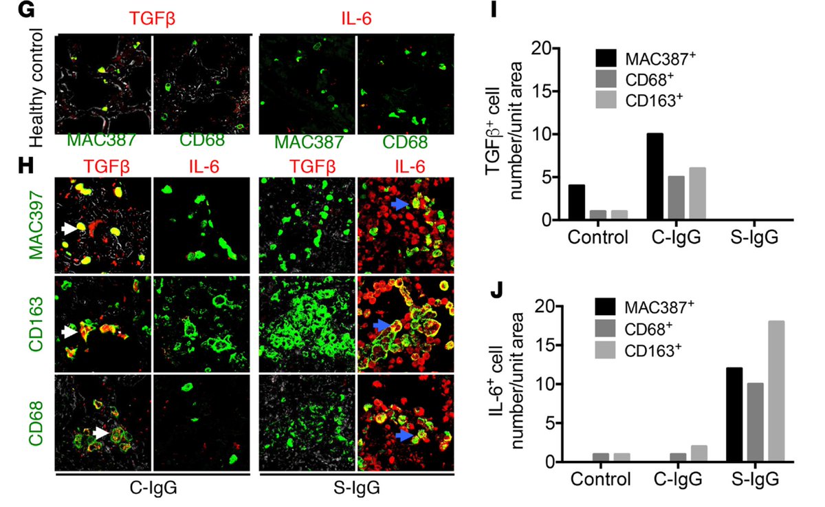Anti-Spike IgG fails to prevent viral entry. Instead, it binds to virus, facilitating uptake by macrophages expressing FcR. This leads to macrophage stimulation and their production of proinflammatory cytokines (IL-6, IL-8, MCP1) and loss of tissue-repair cytokine (TGFb). (4/n)